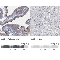 AK7 Antibody, Novus Biologicals 25 &mu;L; Unlabeled:Antibodies, Polyclonal
